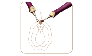 Stimulateur 3 en 1 Bess